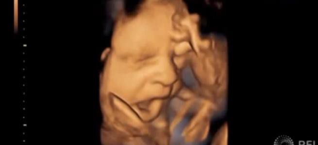 beba-ultrazvuk
