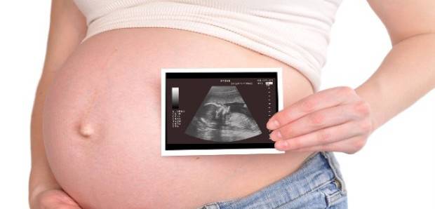 trudnica-ultrazvuk