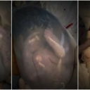 Jedan u 80.000 slučajeva: Čudesni video bebe rođene u vodenjaku dirnuo milione