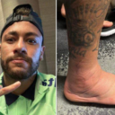 Brazilci opravdano zabrinuti: Neymar pokazao kako izgleda njegov zglob nakon povrede