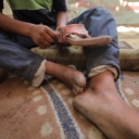 Palestinski medicinski tehničar: Kako bi prehranila djecu, majka u Gazi prodaje bubreg